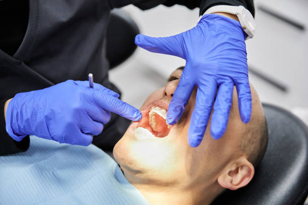 Best Chipped Tooth Repair Near Me  in Idalou, TX